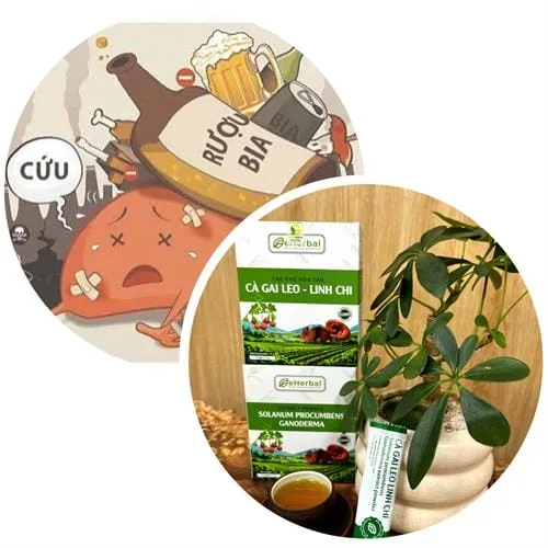 Gan nhiễm mỡ, men gan cao do rượu bia: Phác đồ từ Cà gai leo - Linh chi